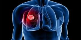 كيف نحجت السويد في خفض نسبة الوفيات بسرطان الرئة لـ42%؟