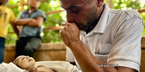وفاة رضيعة جراء المجاعة في خان يونس