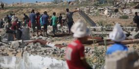 غزة: 61 شهيدا بنيران الاحتلال و8 وفيات بسبب المجاعة