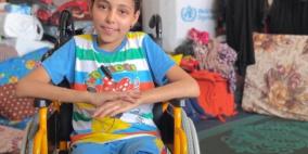 سما من تحت الركام: طفلة تناشد العالم لاستعادة قدميها وحياتها