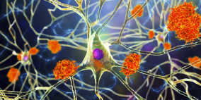 خلطة دوائية ترمم الأعصاب التالفة بسبب التصلب اللويحي