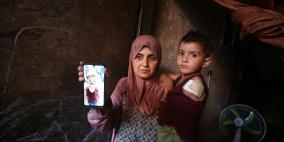 الصحة العالمية: 42 ألف شخص في غزة يعانون إصابات غيّرت مجرى حياتهم