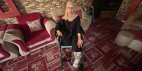 خاص| بعد فقد أربع بنات وساق مبتورة.. حنين تصرخ من أجل الحياة