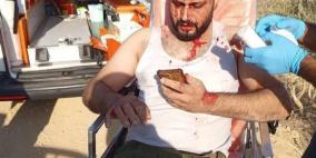 اصابات جراء هجوم الاحتلال ومستوطنيه على قاطفي الزيتون جنوب نابلس