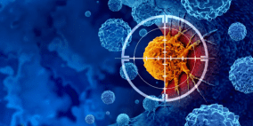 الإشعاع بديل فعّال للجراحة في سرطان الرئة.. ماذا تقول الدراسة؟