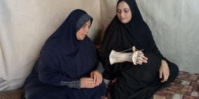 أميرة سليمان… جرح لا يلتئم: بين الألم والرجاء بالعلاج