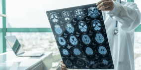 تقدّم طبي لافت.. قطرات أنفية لعلاج سرطان خطير