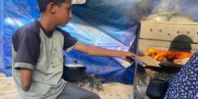 أحمد… طفلٌ خرج من بين الرماد يحمل نصف جسدٍ وقلبًا كاملًا