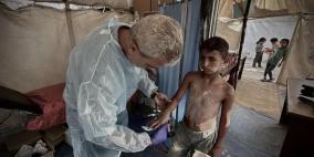 الطب الوقائي بغزة يكشف لراية طبيعة الفيروس الفتاك المنتشر حاليا