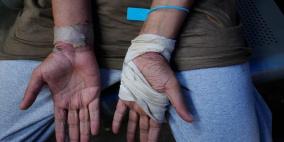 خاص | تقارير جديدة توثق تعرض الأسرى للتعذيب وحراك عالمي لإنقاذهم