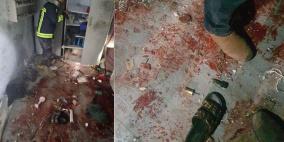 5 شهداء ومصابون وأضرار جراء سقوط 198 شظية صاروخية بالضفة خلال 3 أيام