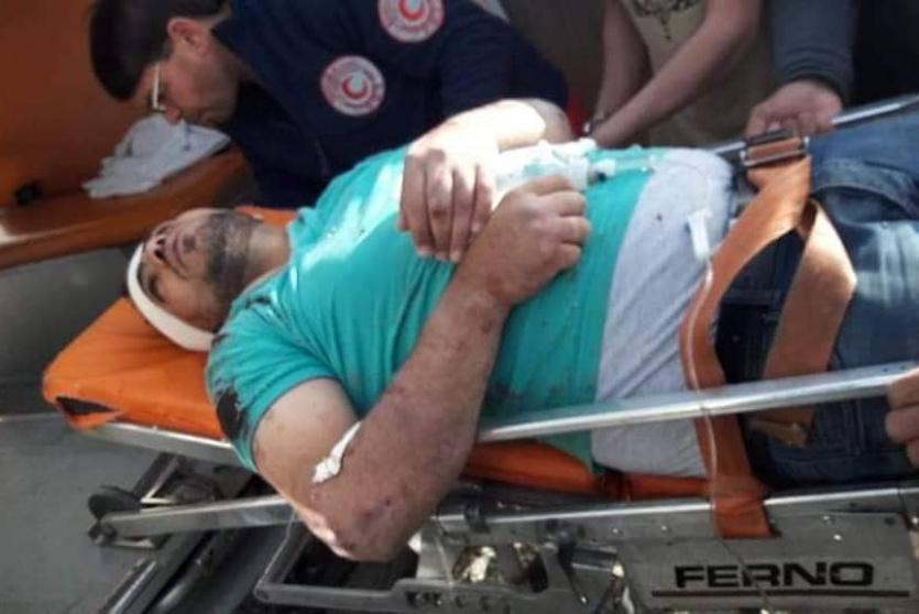 إصابة مواطن برصاص مجهولين جنوب الخليل