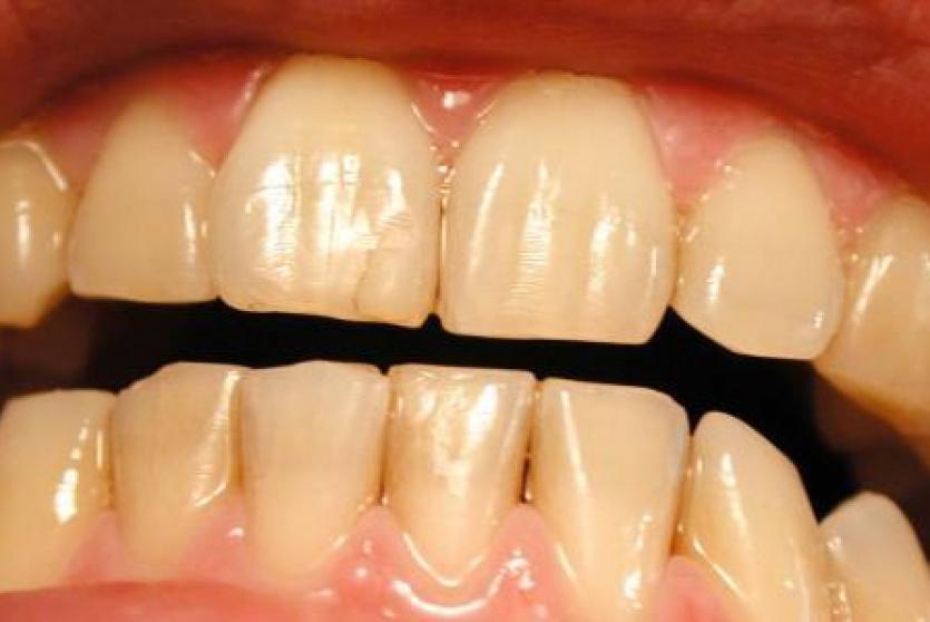 صورة توضيحية