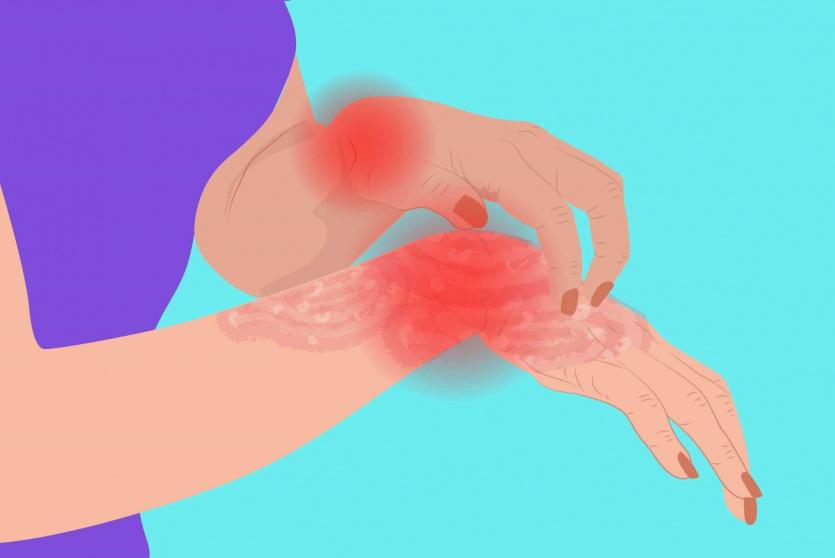 صورة توضيحية