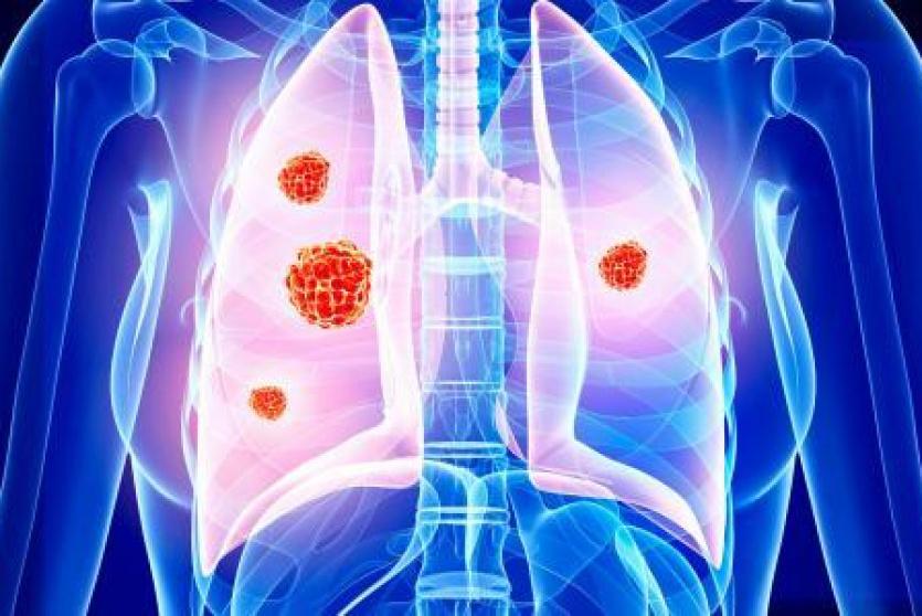 صورة توضيحية