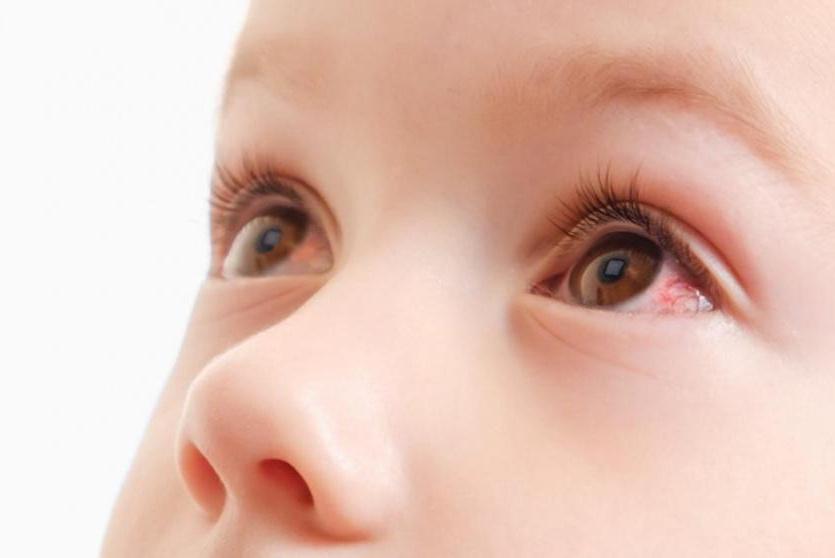 صورة توضيحية