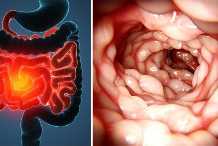 صورة توضيحية