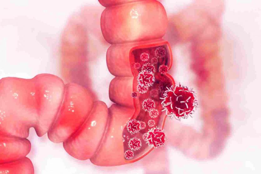 صورة توضيحية