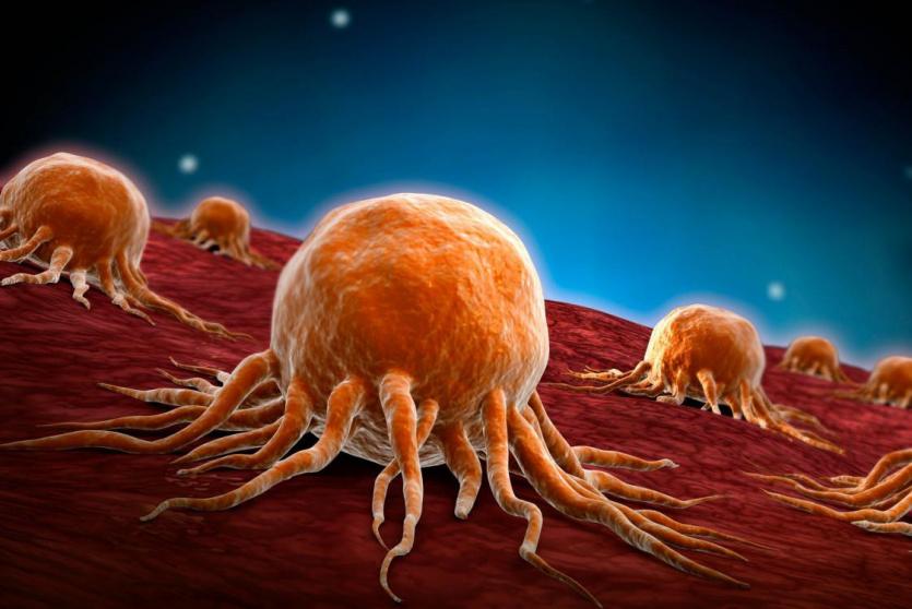 خلايا سرطانية