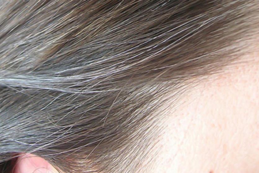 الشعر الأبيض