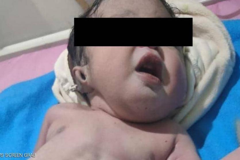 الطفل ولد حيا وتوفي على الفور