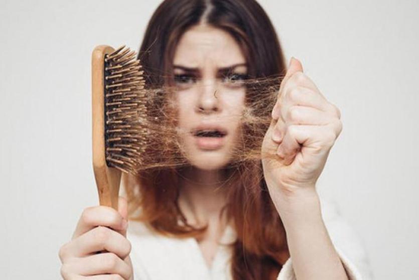 سقوط الشعر -أرشيف-