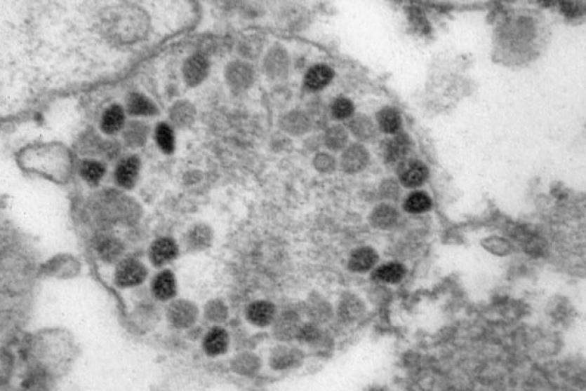 البرازيل: أول وفاة بمتحور أوميكرون لشخص مطعم بـ3 جرعات