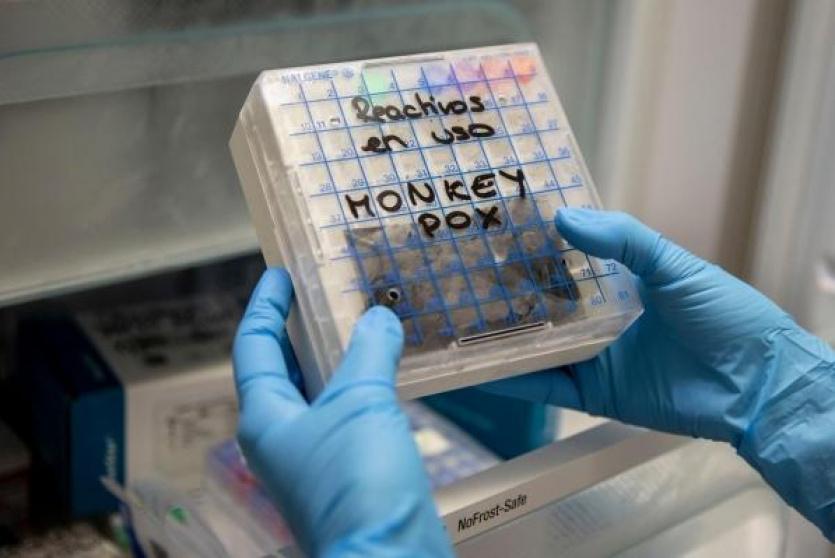 فيروس جدري القرود