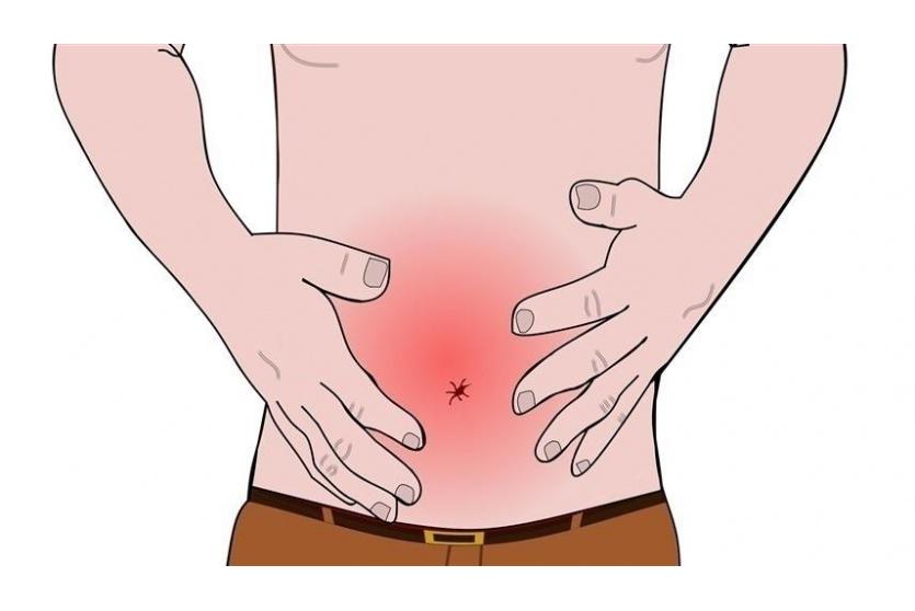 كبسولة اهتزازية تعالج الإمساك المزمن