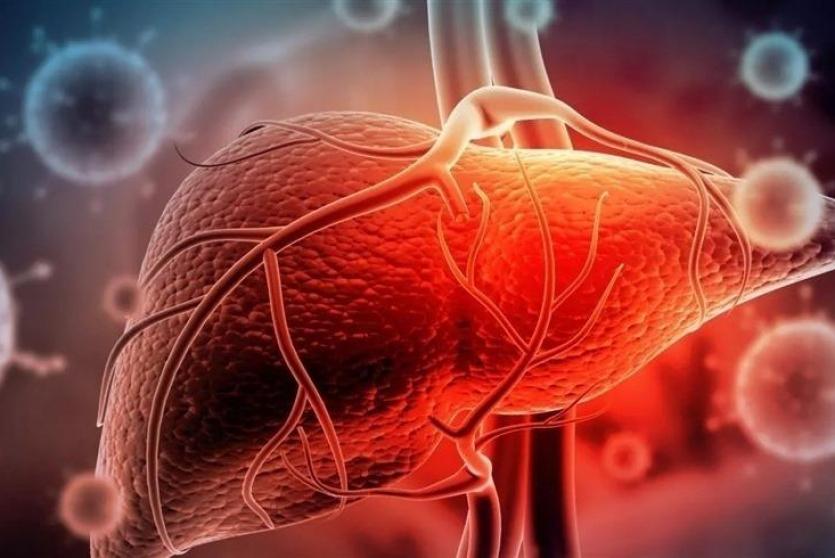 التهاب الكبد