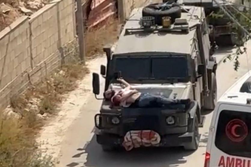 خلال تنكيل الاحتلال بشاب مصاب