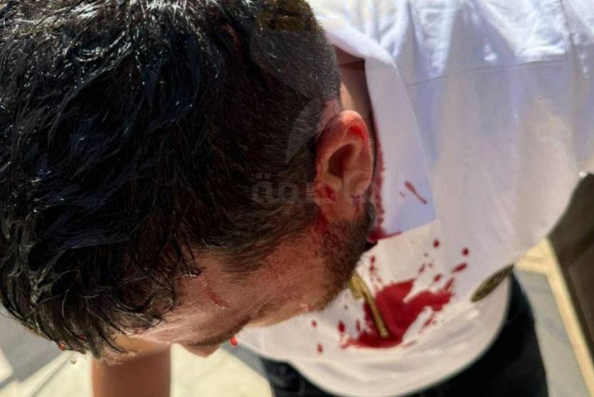 الشاب المصاب