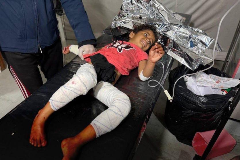 طفلة أصيبت جراء الغارات فجر اليوم