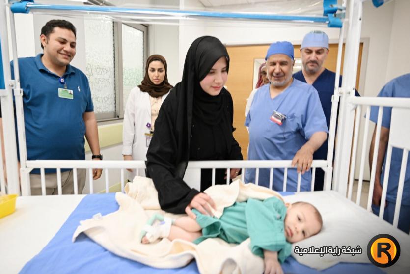 التوأم الطفيلي المصري