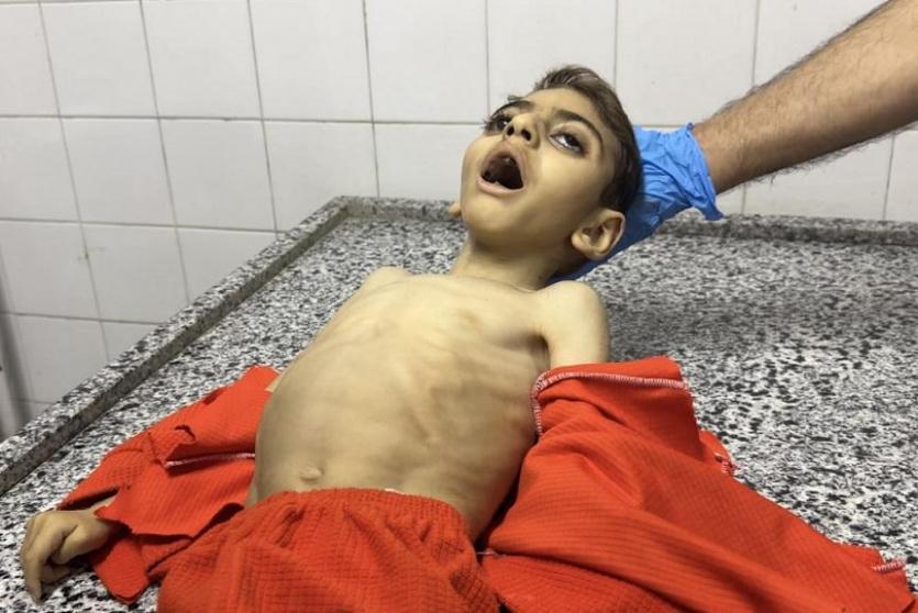 وفاة الطفل محمد ياسين