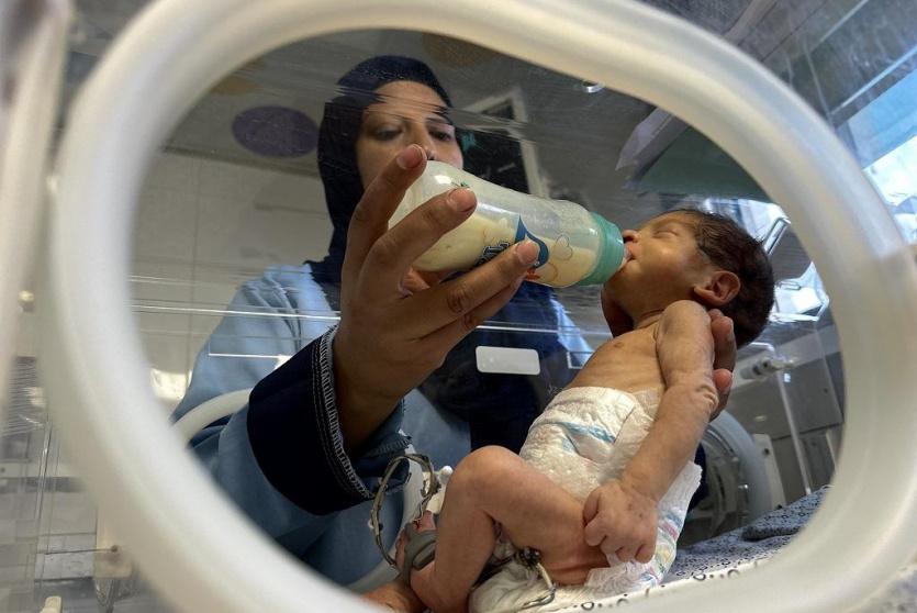 رضيع يتلقة الرعاية الطبية - ارشيفية