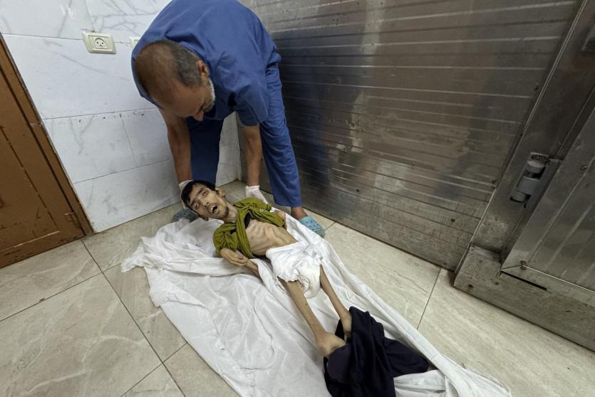 الجوع يفتك بأطفال غزة