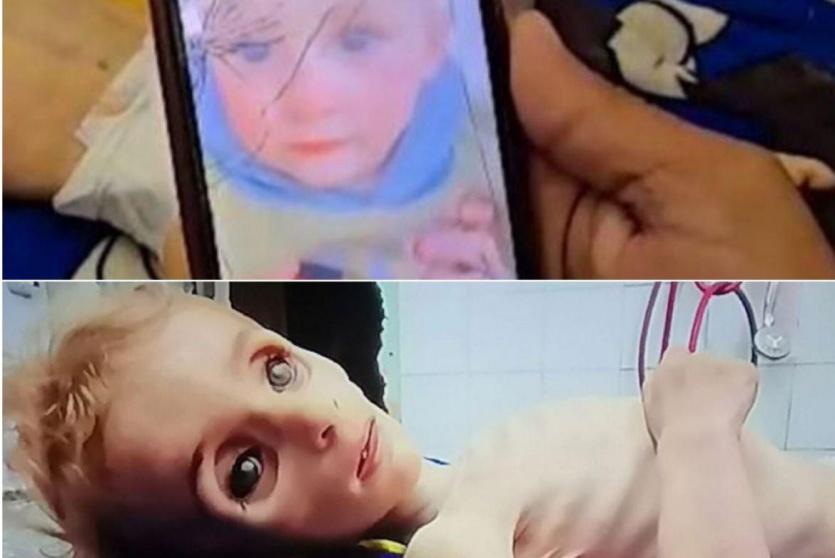 وفاة الطفلة سناء اللحام 