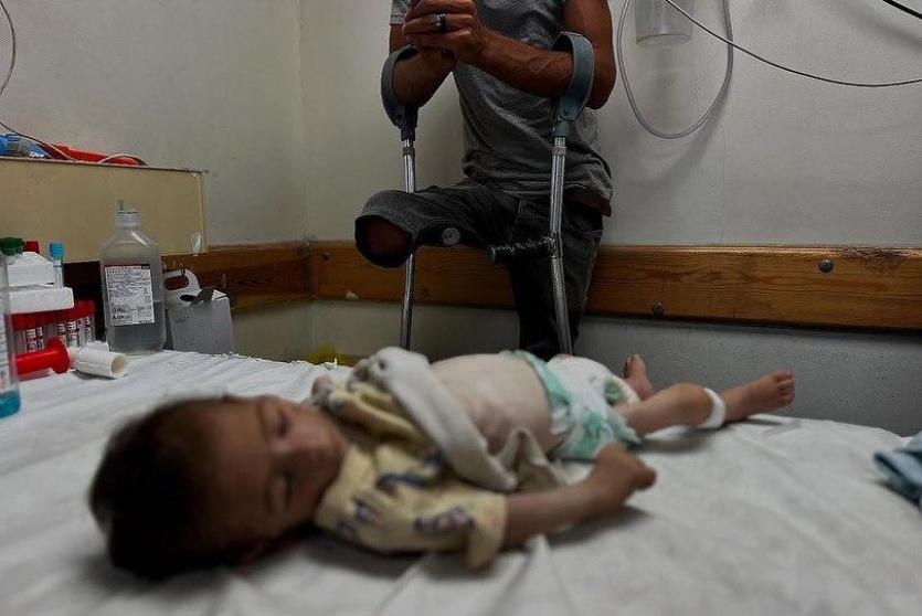 ارتفاع عدد شهداء التجويع في غزة إلى 122