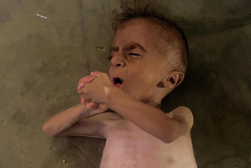 إسرائيل ترتكب إبادة جماعية وتجويع جماعي في غزة