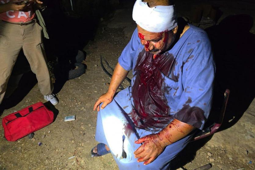 المواطن المصاب