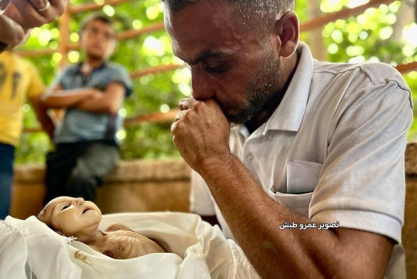 صورة الطفلة التي توفيت بسبب المجاعة