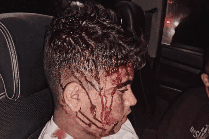 طفل أصيب في اعتداء المستوطنين فجر اليوم