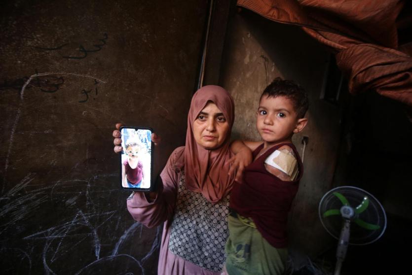 طفل مصاب في غزة