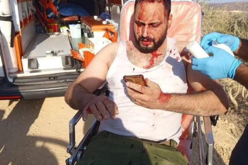 أحد المصابين في قبلان