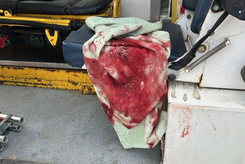 من اسعاف الطفلين المصابين